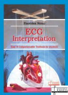 ECG Interpretation