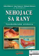 Nehojace sa rany