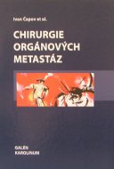 Chirurgie orgánových metastáz