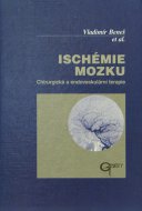 Ischémie mozku 