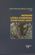 Moderní léčba syndromu diabetické nohy 