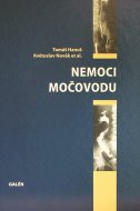 Nemoci močovodu