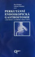 Perkutánní endoskopická gastrostomie a její místo v algoritmu umělé výživy