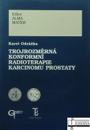 Trojrozměrná konformní radioterapie karcinomu prostaty