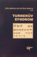 Turnerův syndrom 