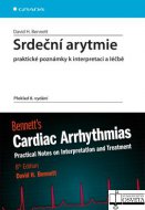 Srdeční arytmie praktické poznámky k interpretaci a léčbě