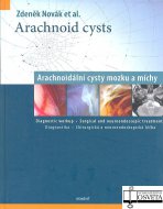 Arachnoid cysts / Arachnoidální cysty mozku a míchy