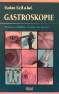 Gastroskopie