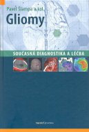 Gliomy – současná diagnostika a léčba