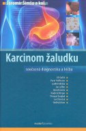 Karcinom žaludku. Současná diagnostika a léčba