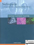 Nefropatie v ultrazvukovém a histologickém obraze