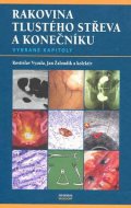 Rakovina tlustého střeva a konečníku