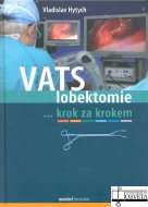 VATS lobektomie krok za krokem