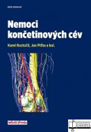 Nemoci končetinových cév
