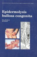 Epidermolysis bullosa congenita