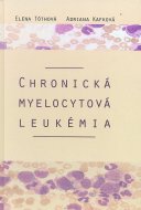 Chronická myelocytová leukémia