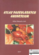 Atlas vaskulárnych aneuryziem
