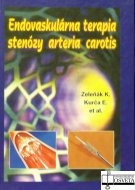 Endovaskulárna terpia stenózy arteria carotis