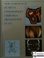 Funkčná endoskopická chirurgia prinosových dutín