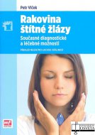 Rakovina štítné žlázy