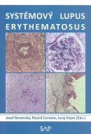 Systémový lupus erythematosus 