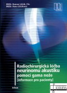 Radiochirurgická léčba neurinomu akustiku pomocí gama nože