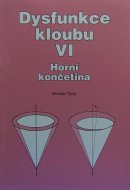 Dysfunkce kloubu VI. Horní končetina