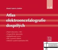 Atlas elektroencefalografie dospělých