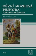 Cévní mozková příhoda v medicínske praxi