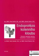 Endoprotéza kolenního kloubu 