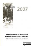 Stručný přehled patologie nádorů nervového systému