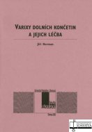 Varixy dolních končetin a jejich léčba