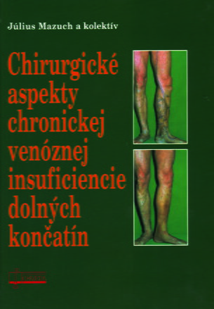 Chirurgické aspekty chronickej venóznej insuficiencie dolných končatín