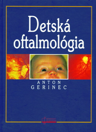 Detská oftalmológia          