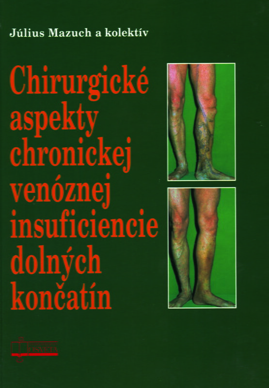 Chirurgické aspekty chronickej venóznej insuficiencie dolných končatín
