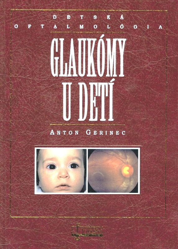 Glaukómy u detí