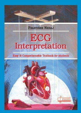 ECG Interpretation